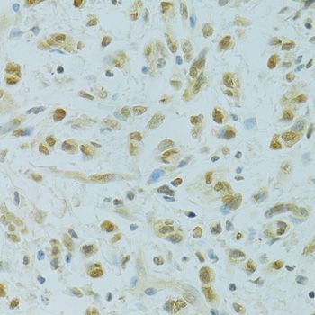 Immunohistochemistry - RCC1 Polyclonal Antibody (144-06350)