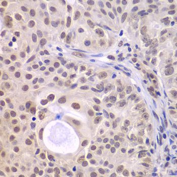 Immunohistochemistry - DDX5 antibody (144-60268)