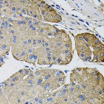 Immunohistochemistry - THBS2 antibody (144-08561)
