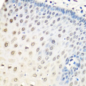 Immunohistochemistry - HNRNPA0 Polyclonal Antibody (144-06029)