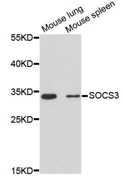 Western blot - SOCS3 Polyclonal Antibody (144-00769)