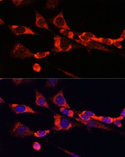 Immunofluorescence - SELL antibody (144-01622)