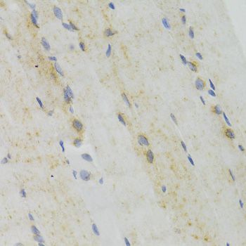 Immunohistochemistry - GEMIN2 Antibody (144-03082)