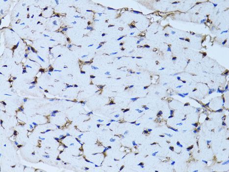 Immunohistochemistry - FABP4 Polyclonal Antibody (144-00232)