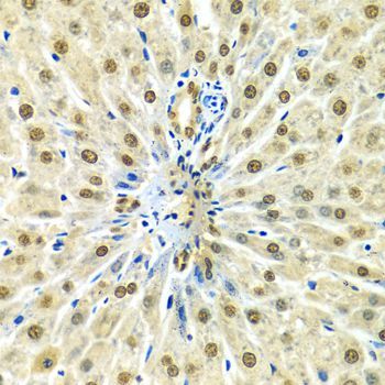 Immunohistochemistry - [KO Validated] HNRNPA2B1 Polyclonal Antibody (144-01162)
