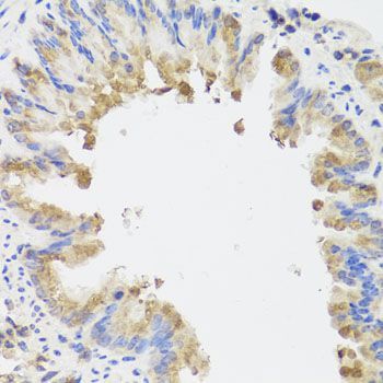 Immunohistochemistry - FLJ20294 Polyclonal Antibody (144-01083)