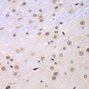Immunohistochemistry - RNF2 Polyclonal Antibody (144-05563)