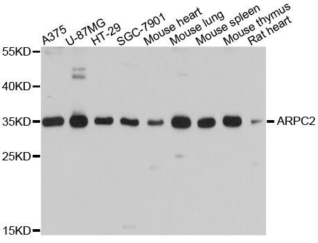 Western blot - ARPC2 Polyclonal Antibody (144-10791)