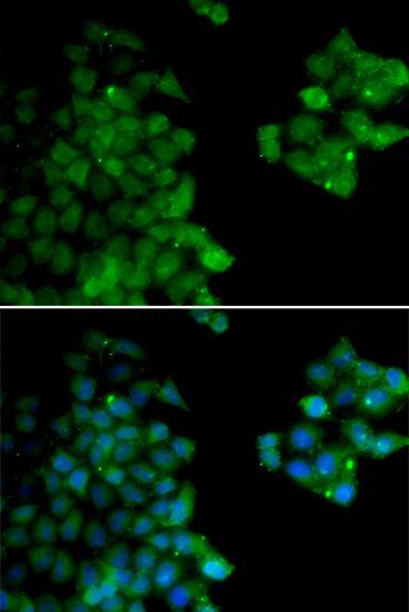 Immunofluorescence - PSMB10 antibody (144-05452)