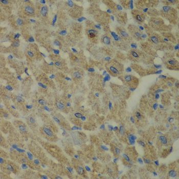 Immunohistochemistry - CCBL1 Polyclonal Antibody (144-06542)