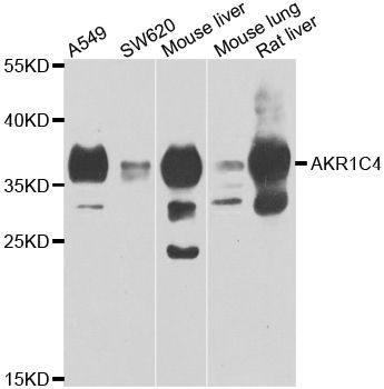 Western blot - AKR1C4 antibody (144-07430)