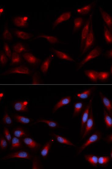 Immunofluorescence - ADAM9 antibody (144-05388)