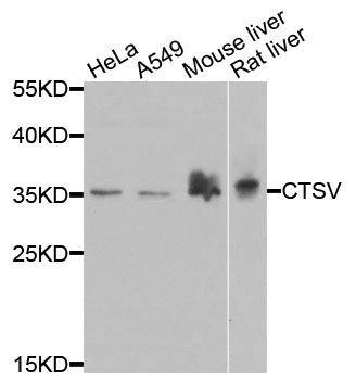 Western blot - CTSV antibody (144-07662)
