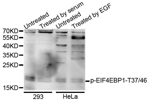 Western blot - Phospho-EIF4EBP1-T37/46 antibody (144-61486)