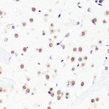 Immunohistochemistry - Asymmetric DiMethyl-Histone H3-R2 pAb (144-03155)