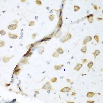 Immunohistochemistry - ELAVL2 antibody (144-05918)