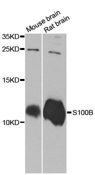 Western blot - S100B Polyclonal Antibody (144-00676)