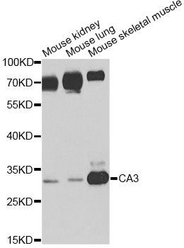Western blot - CA3 antibody (144-60352)