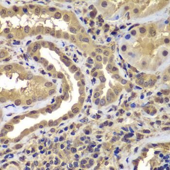 Immunohistochemistry - PSMB8 antibody (144-07340)