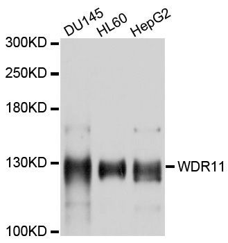 Western blot - WDR11 Polyclonal Antibody (144-010590)