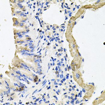 Immunohistochemistry - MYH7 antibody (144-07564)