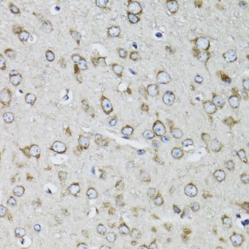 Immunohistochemistry - RPS10 Polyclonal Antibody (144-05880)