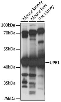 Western blot - UPB1 antibody (144-61063)