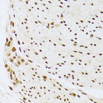 Immunohistochemistry - ANP32A Antibody (144-05768)