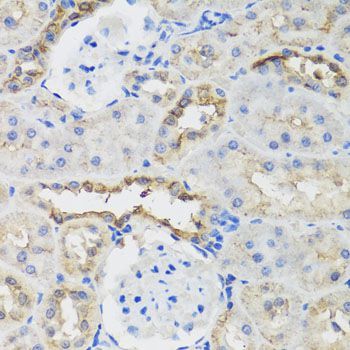 Immunohistochemistry - B9D1 antibody (144-07973)