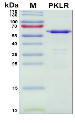 SDS-PAGE