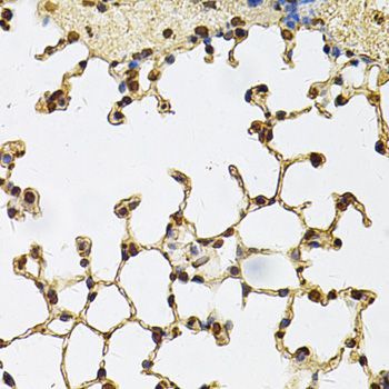 Immunohistochemistry - IFI16 Antibody (144-60546)
