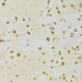 Immunohistochemistry - HDGF Antibody (144-05347)