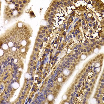 Immunohistochemistry - CLASP1 antibody (144-07081)