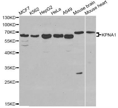 Western blot - KPNA1 antibody (144-01742)