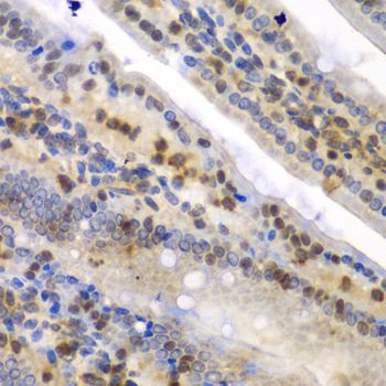 Immunohistochemistry - SYNCRIP Polyclonal Antibody (144-07219)