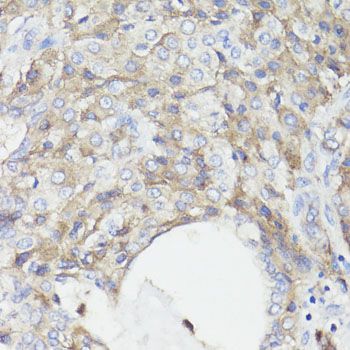 Immunohistochemistry - CD59 antibody (144-01689)