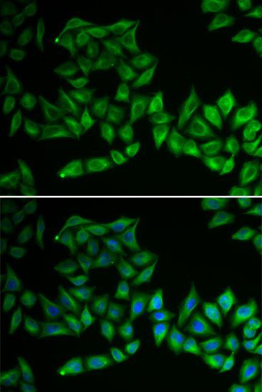 Immunofluorescence - TPMT Polyclonal Antibody (144-01017)