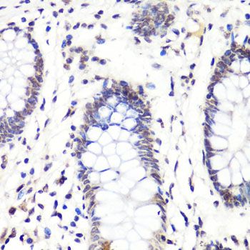 Immunohistochemistry - Asymmetric DiMethyl-Histone H3-R2 pAb (144-03155)