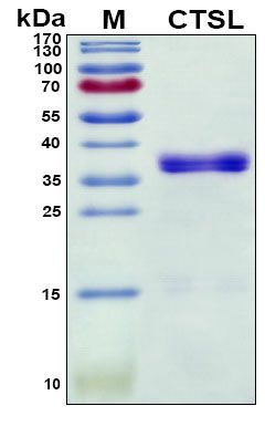 SDS-PAGE