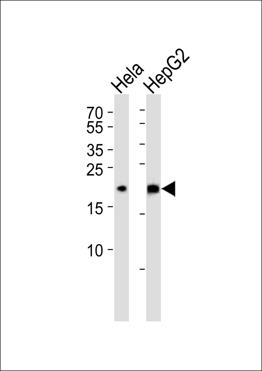 WB