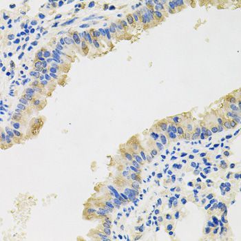 Immunohistochemistry - IL8 Polyclonal Antibody (144-02541)