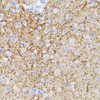 Immunohistochemistry - NTF3 antibody (144-012476)