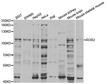 Western blot - ROR2 antibody (144-05620)