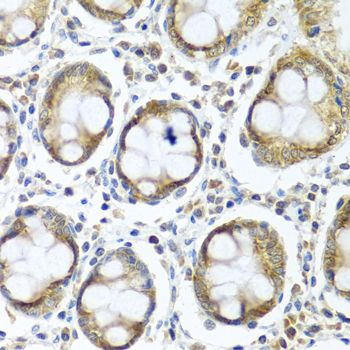 Immunohistochemistry - IFI44 antibody (144-08188)
