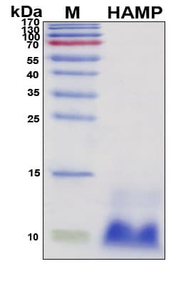 SDS-PAGE Image