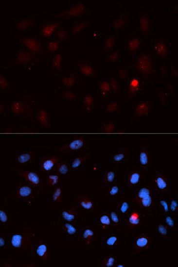 Immunofluorescence - Phospho-CDK1-T14 antibody (144-50015)