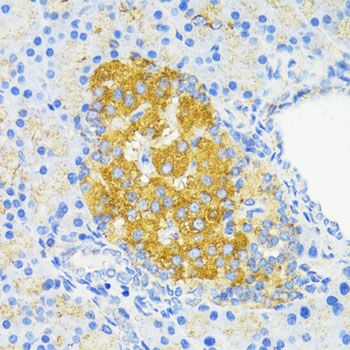 Immunohistochemistry - CCND1 Polyclonal Antibody (144-11022)