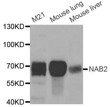 Western blot - NAB2 antibody (144-05827)