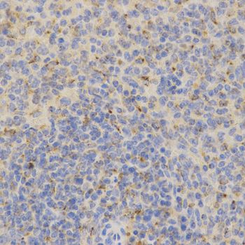 Immunohistochemistry - PSAP Antibody (144-01819)