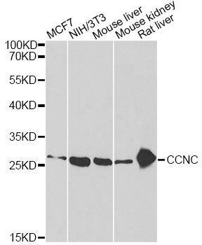Western blot - CCNC Polyclonal Antibody (144-06545)